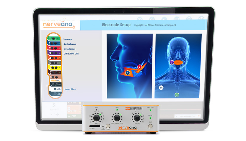 Nerveäna Plus nerve monitoring system Efficiency Neurovision's Nerveäna Plus, Nerve Monitoring System Neuromonitoring Products
