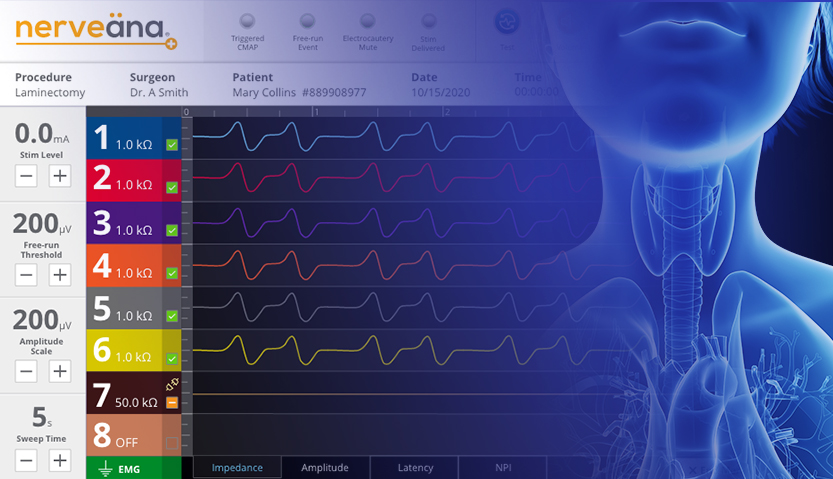 Neurovision Nerveana Plus nerve monitoring system. Intraoperative Neuromonitoring Products.