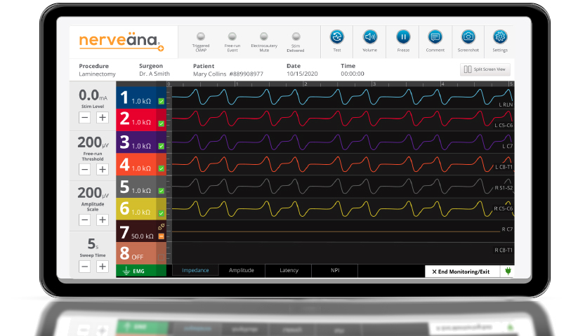 Intraoperative Neuromonitoring Products_Nerveäna Plus Nerve Monitoring System - EMG View Neuromonitoring Software