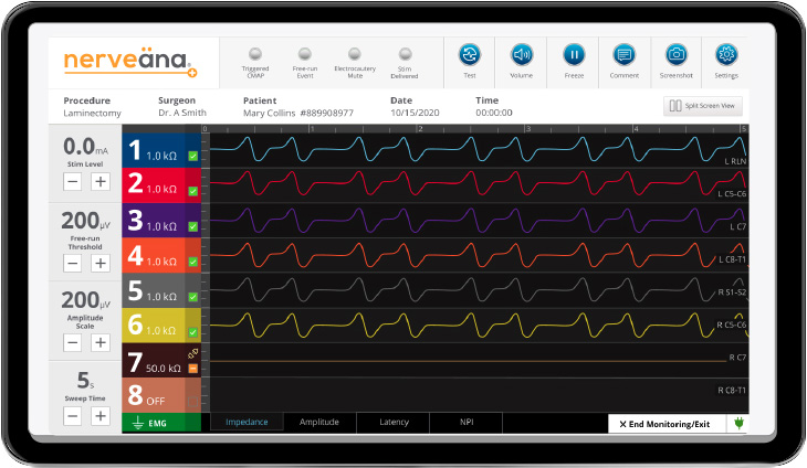 NV-transforms-crop Intraoperative Neuromonitoring Product details for the Nerveana Plus nerve monitoring system.